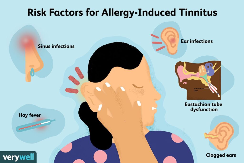 Tinnitus (Ringing of the Ears) Causes, Risk Factors, Pathophysiology,  Symptoms, Diagnosis, Treatment - YouTube