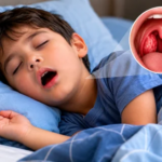 Snoring and Mouth-breathing in the child