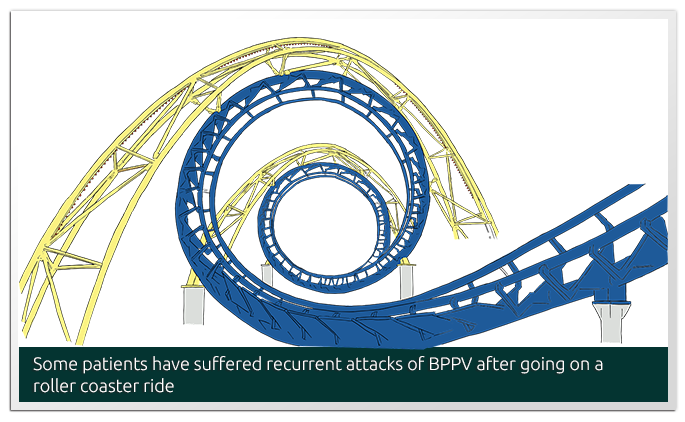 Dizziness, balance vertigo Mount Elizabeth Novena Singapore