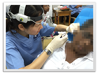 Cleaning the Ear Without Microscope Hambantota 2015