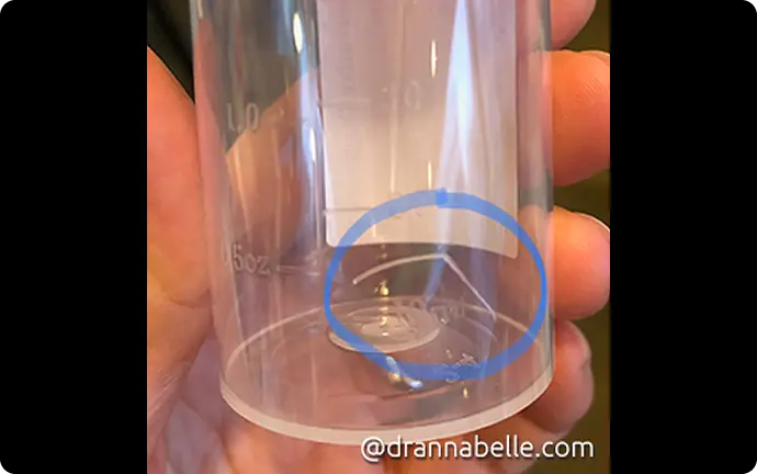 A 3 cm fishbone wedged at the back of the tongue