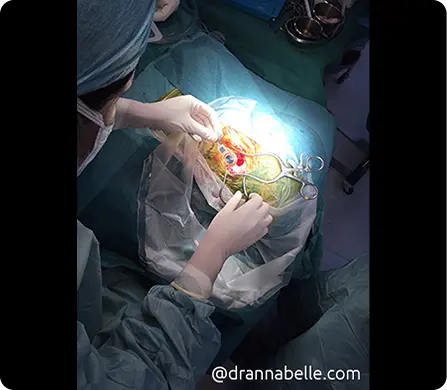 Dr Annabelle performing Bonebridge implant surgery