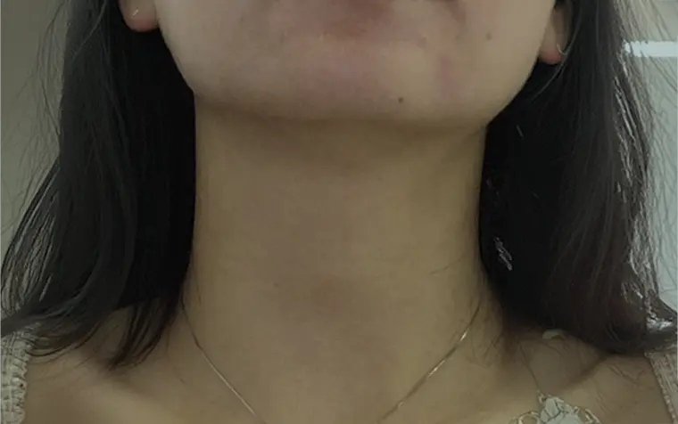 woman touching her throat